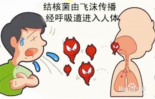 如何預防肺結核？